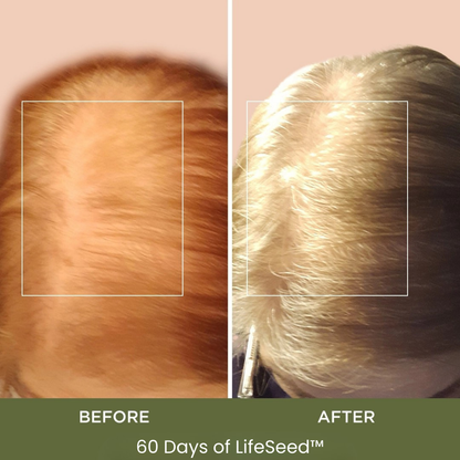 LifeSeed™ Pumpkin Seed Oil Capsules