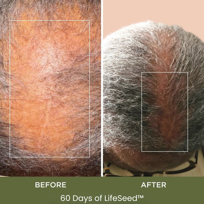 LifeSeed™ Pumpkin Seed Oil Capsules